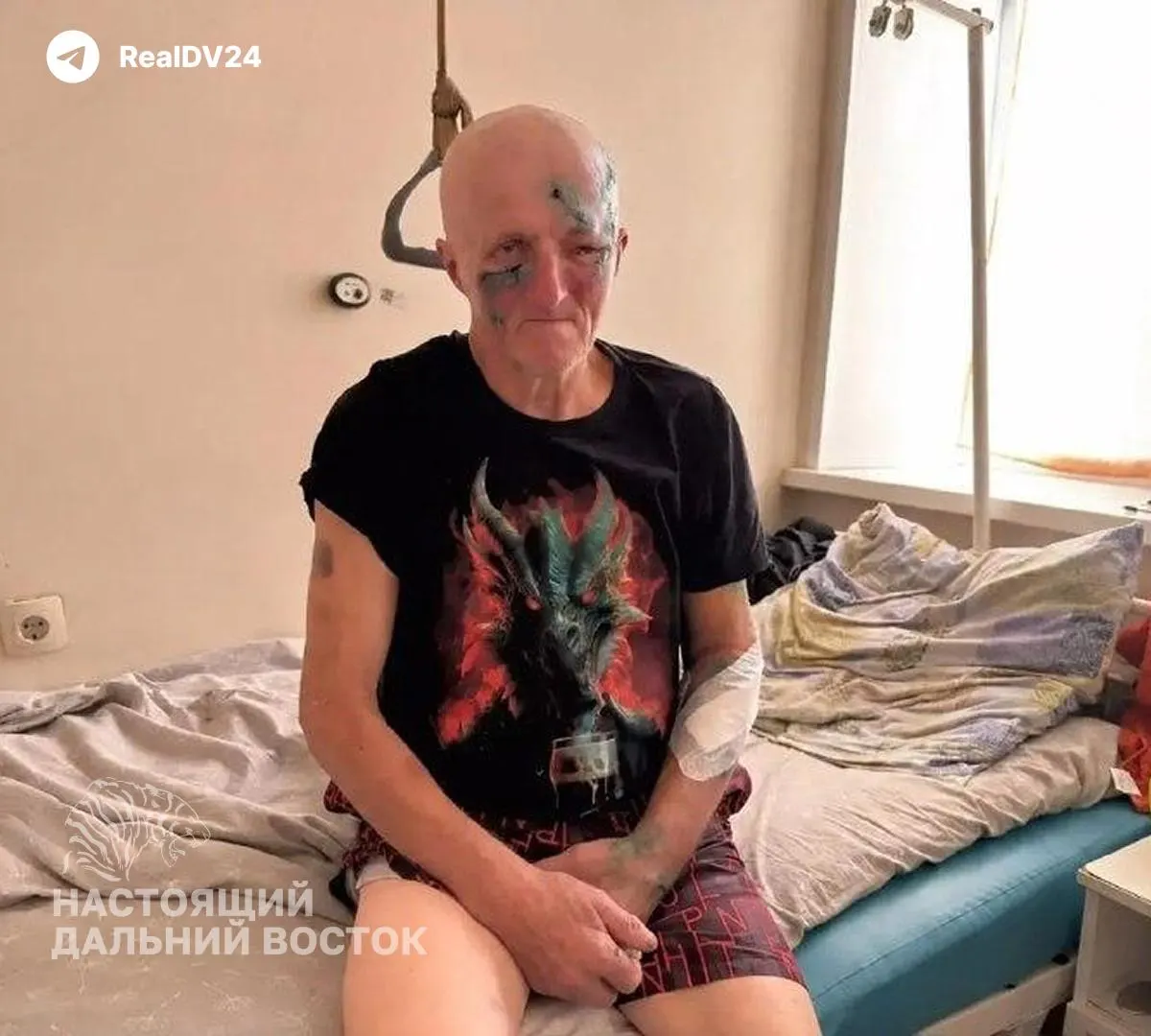 В регионе зафиксированы случаи нападений медведей на людей, власти вводят запреты на самостоятельные визиты и выплаты за уничтожение зверя. Рост активности зверей связывают с климатическими и лесными факторами.